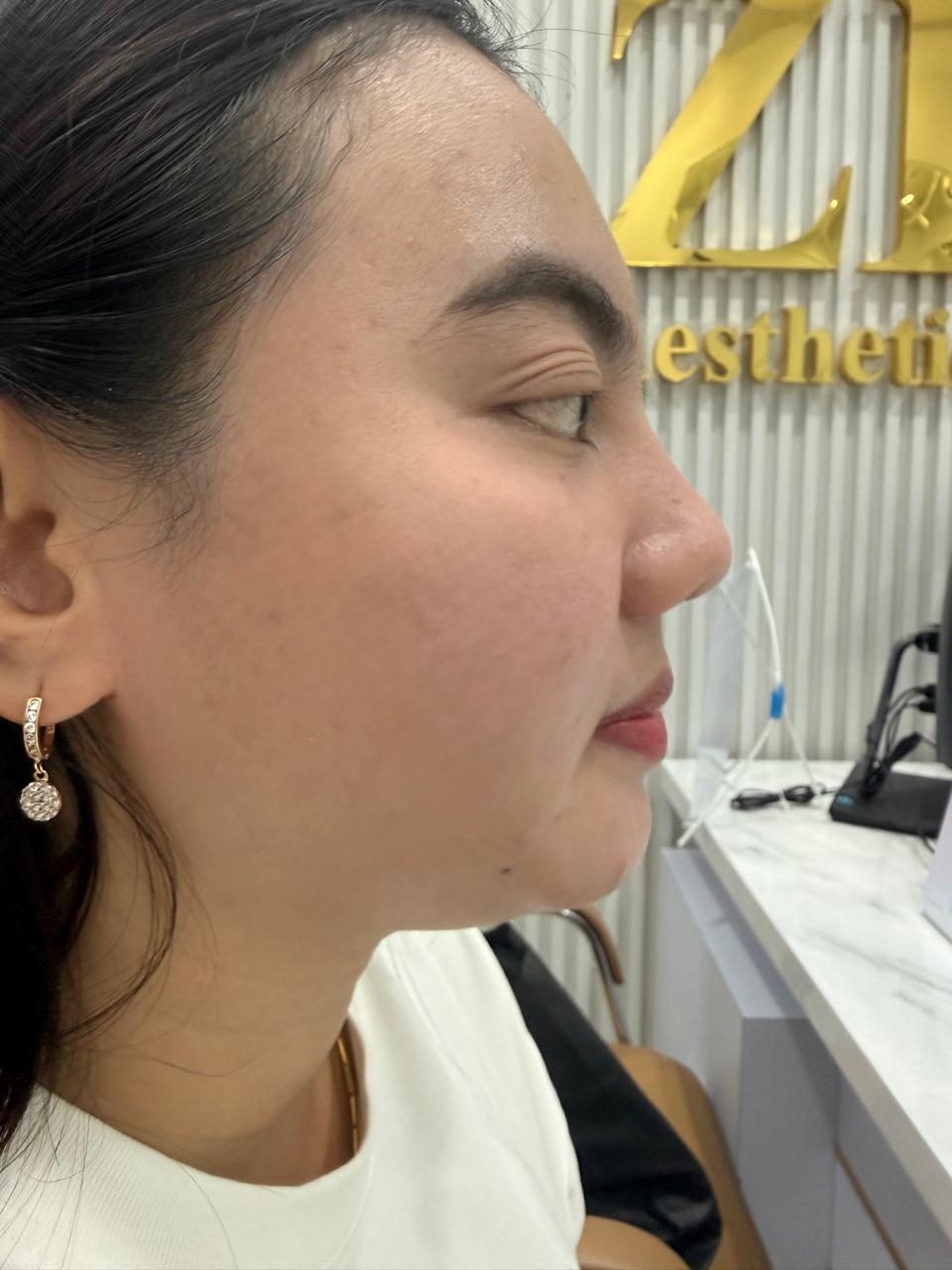 Sebelum - Cellbooster Shape